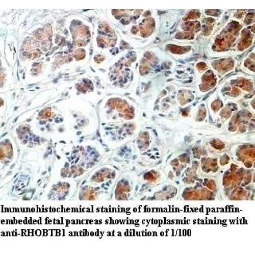 RHOBTB1 Antibody