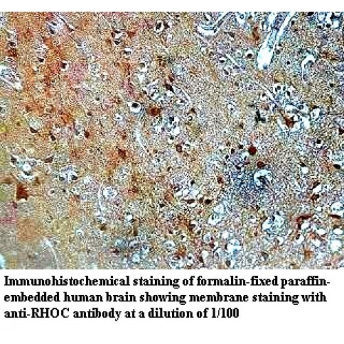 RHOC Antibody