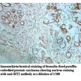 RIT2 Antibody