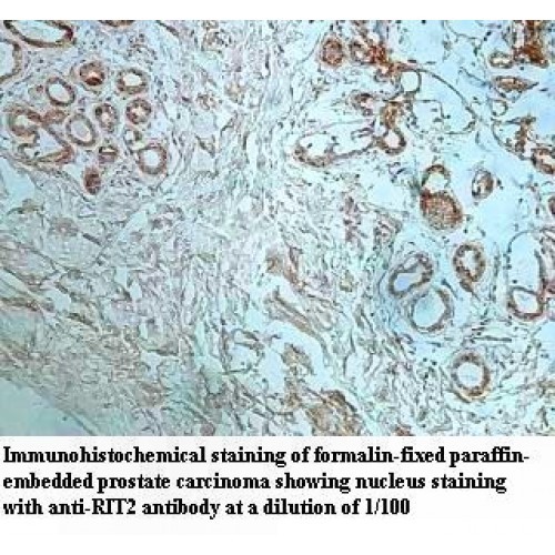 RIT2 Antibody