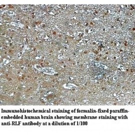 RLF Antibody