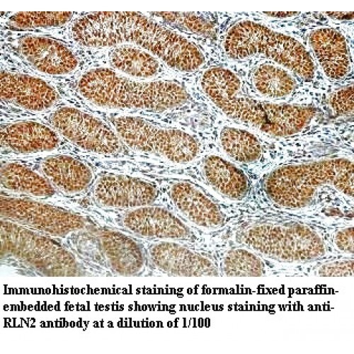 RLN2 Antibody