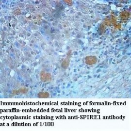 SPIRE1 Antibody