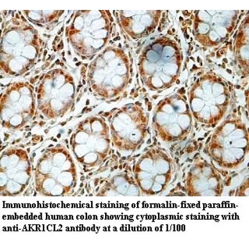 AKR1CL2 Antibody