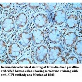 ALPI Antibody