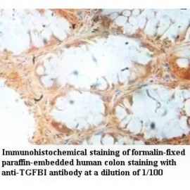 TGFBI Antibody