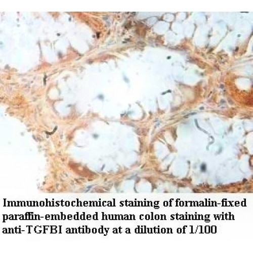 TGFBI Antibody