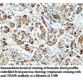 THAP6 Antibody