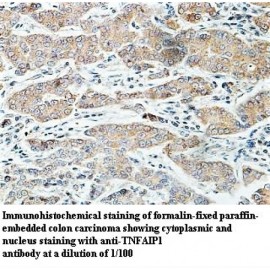TNFAIP1 Antibody