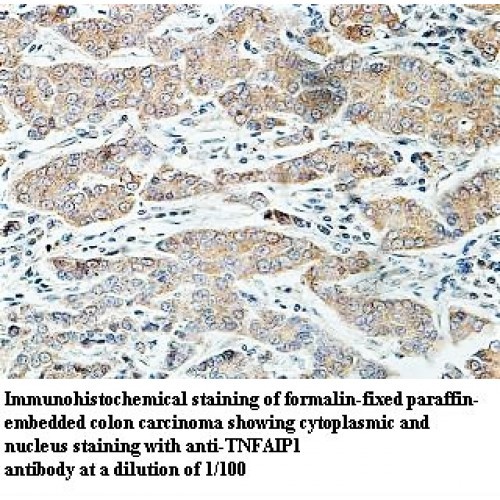 TNFAIP1 Antibody