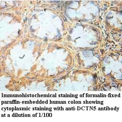 DCTN5 Antibody