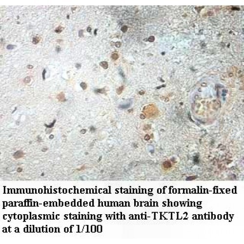 TKTL2 Antibody