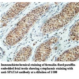 SPATA4 Antibody