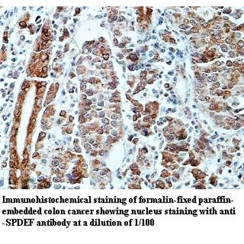 SPDEF Antibody