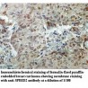 SPRED2 Antibody