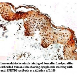 SPRYD5 Antibody