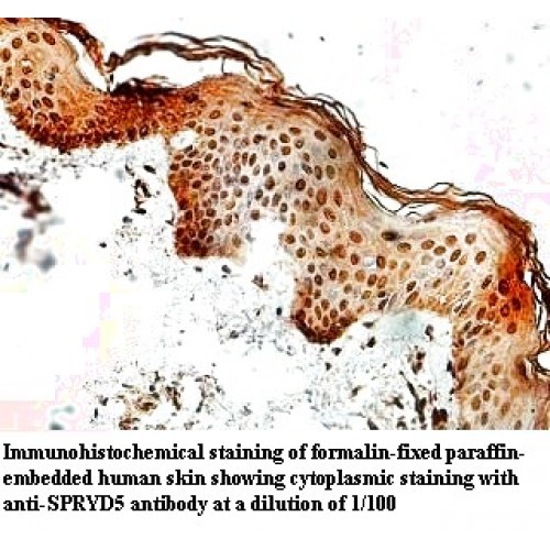 SPRYD5 Antibody