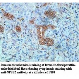 SPSB2 Antibody