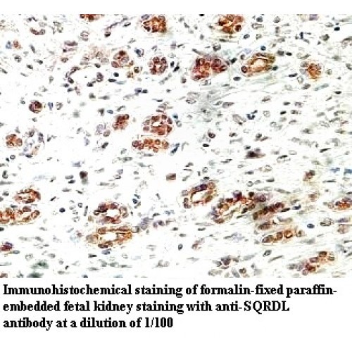 SQRDL Antibody
