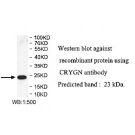CRYGN Antibody