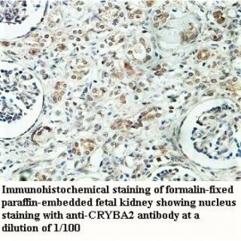 CRYBA2 Antibody