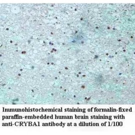 CRYBA1 Antibody
