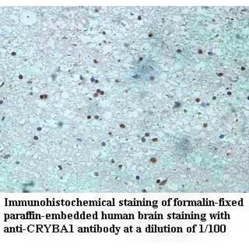 CRYBA1 Antibody