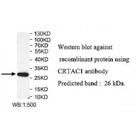 CRTAC1 Antibody
