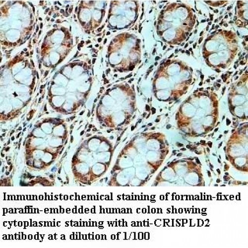 CRISPLD2 Antibody