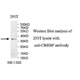 CRHBP Antibody