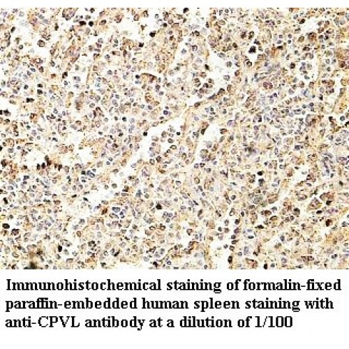 CPVL Antibody