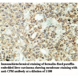 CPM Antibody
