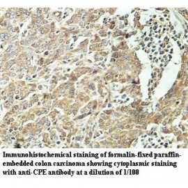 CPE Antibody