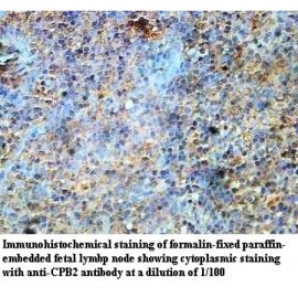CPB2 Antibody