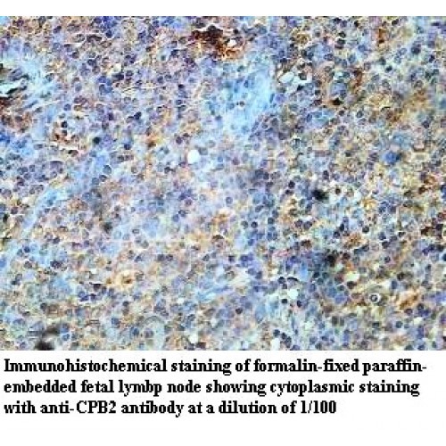 CPB2 Antibody