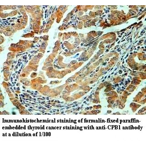 CPB1 Antibody