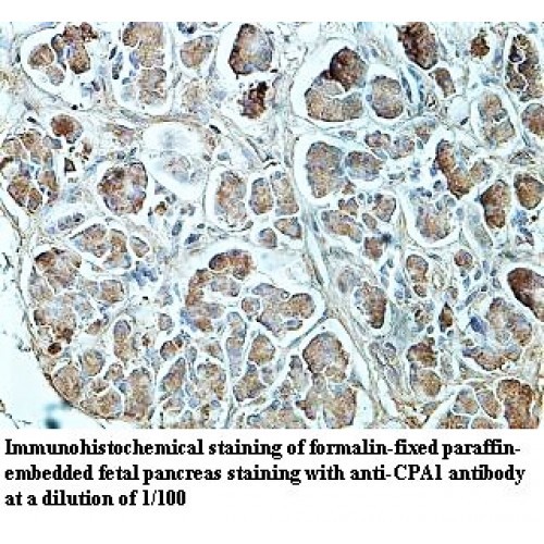 CPA1 Antibody