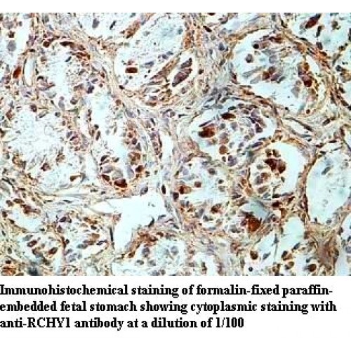 RCHY1 Antibody