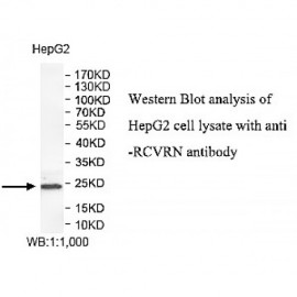 RCVRN Antibody