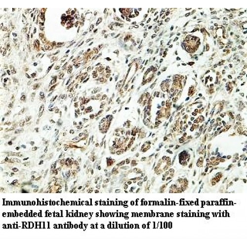 RDH11 Antibody