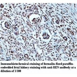REN Antibody