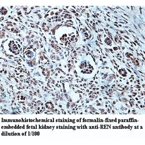 REN Antibody