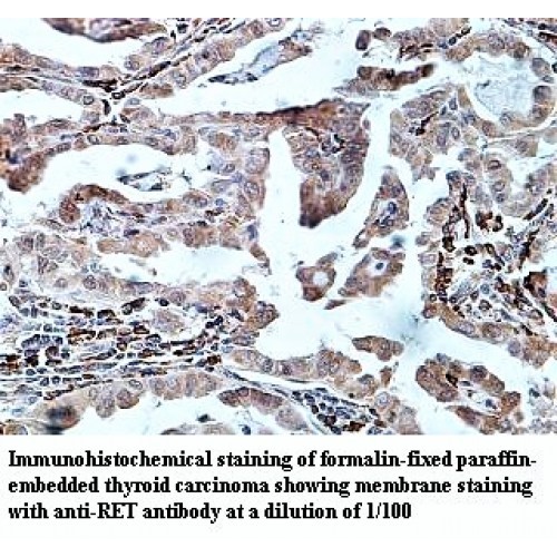 RET Antibody