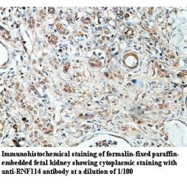 RNF114 Antibody