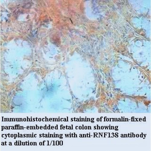 RNF138 Antibody
