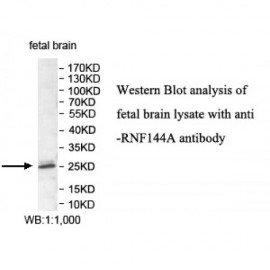 RNF144A Antibody