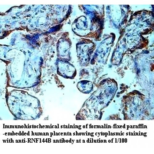 RNF144B Antibody