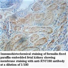 RNF180 Antibody