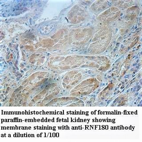 RNF180 Antibody
