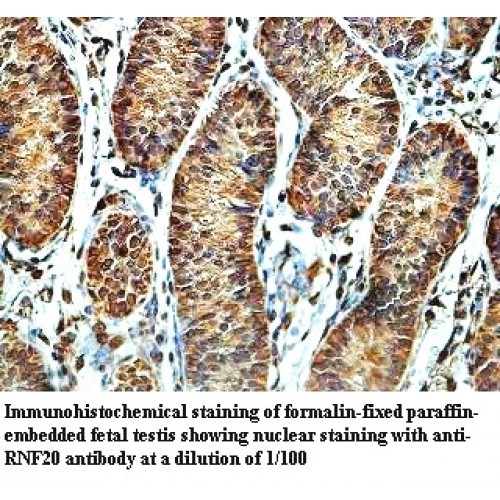 RNF20 Antibody